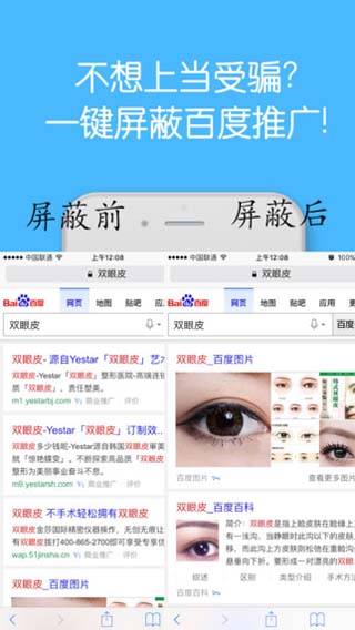 视频广告过滤大师iOS版